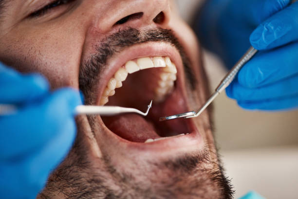 Best Emergency Treatment for Dental Infections or Abscesses in Liberty, UT